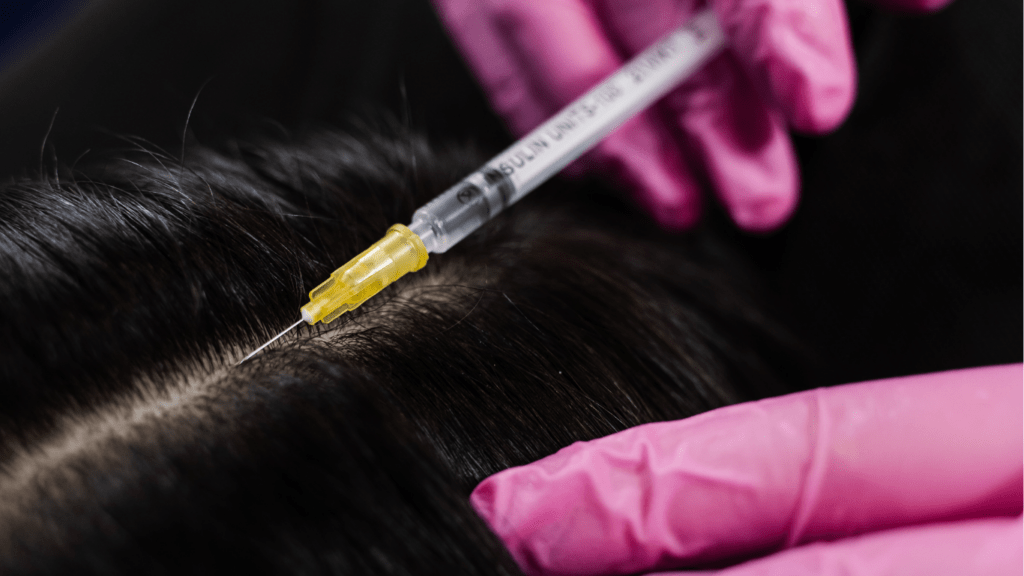 Effective Treatments for Scalp Issues
