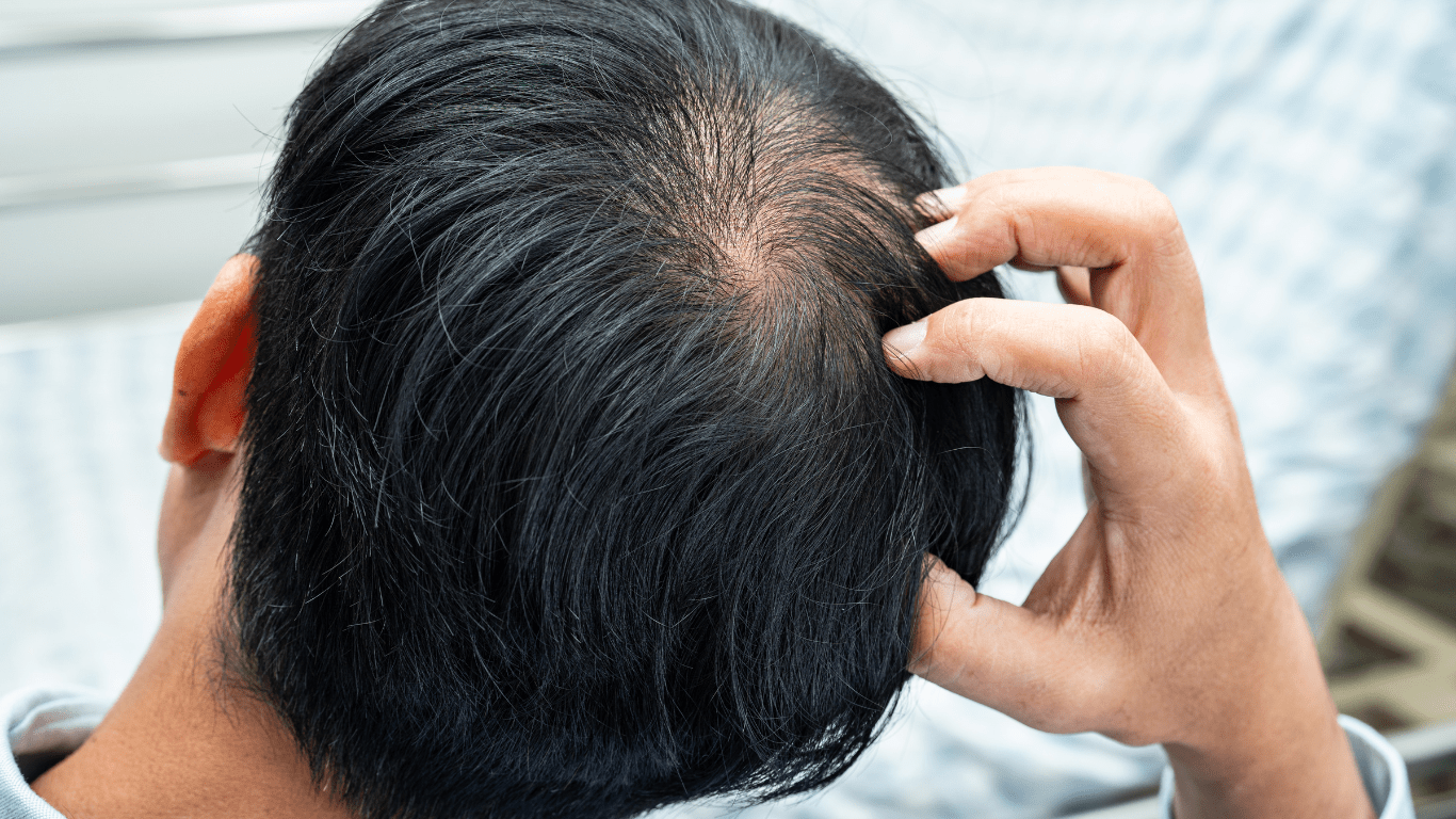 A Man's Scalp